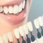 6 benefits of having cosmetic dentistry