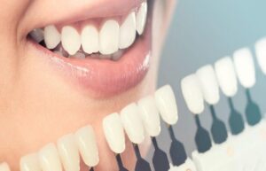 6 benefits of having cosmetic dentistry