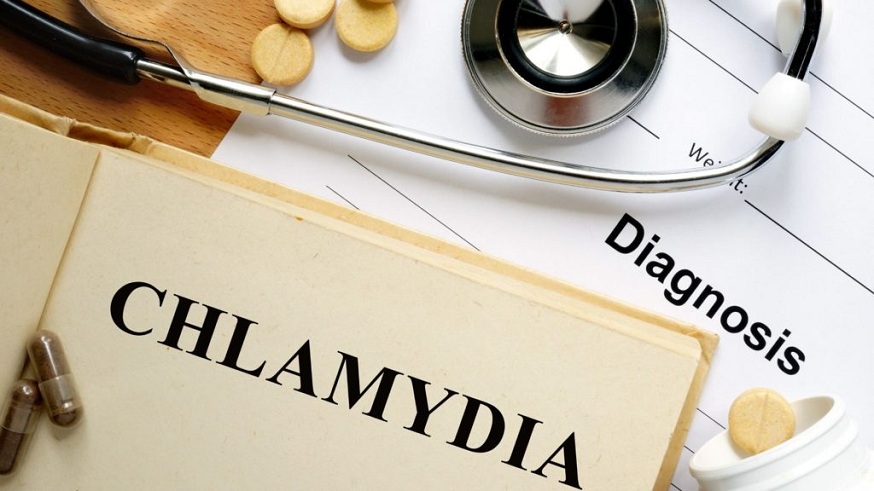 Chlamydia Diagnosed