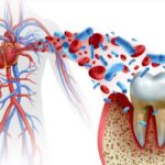 Periodontal Disease And Its Link To Heart Disease