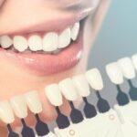 Smile Makeovers in Salt Lake City: How Cosmetic Dentistry Can Transform Your Look